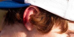 What Should I Do If My Ears Bleed?
